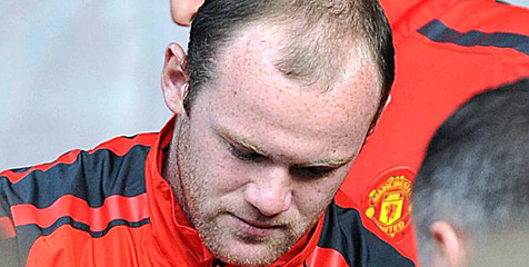Ferguson Redam Rumor Penjualan Rooney ke PSG Ferguson Redam Rumor Penjualan Rooney ke PSG