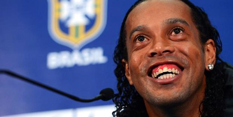 Ronaldinho Lakukan Operasi Guna Percantik Giginya Ronaldinho Lakukan Operasi Guna Percantik Giginya