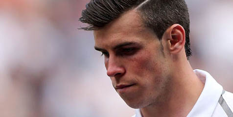 Madrid Konfirmasi Bale Tak Derita Cedera Aneh Madrid Konfirmasi Bale Tak Derita Cedera Aneh