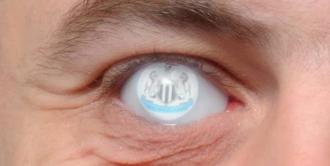 Fan Newcastle Ini Memiliki Mata Berlogo Klub Kesayangannya Fan Newcastle Ini Memiliki Mata Berlogo Klub Kesayangannya