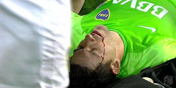Video: Dilempar Batu Oleh Suporter, Kepala Kiper Boca Bersimbah Darah Video: Dilempar Batu Oleh Suporter, Kepala Kiper Boca Bersimbah Darah