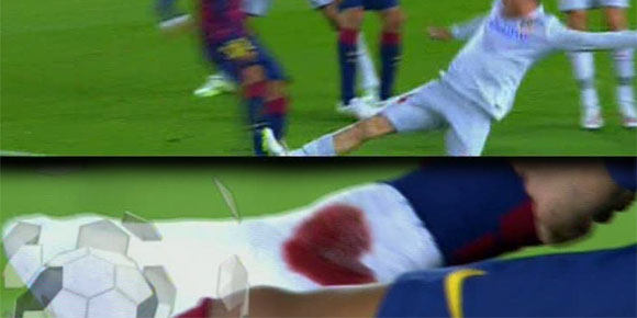 Horor! Tekel Sadis Gimenez pada Neymar Horor! Tekel Sadis Gimenez pada Neymar