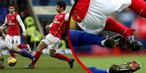 5 Cedera Paling Mengerikan di Sepanjang Sejarah EPL 5 Cedera Paling Mengerikan di Sepanjang Sejarah EPL