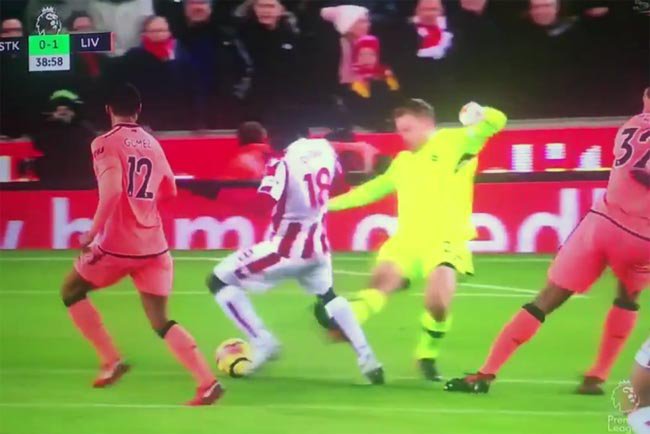 Mignolet menghajar kaki Diouf.