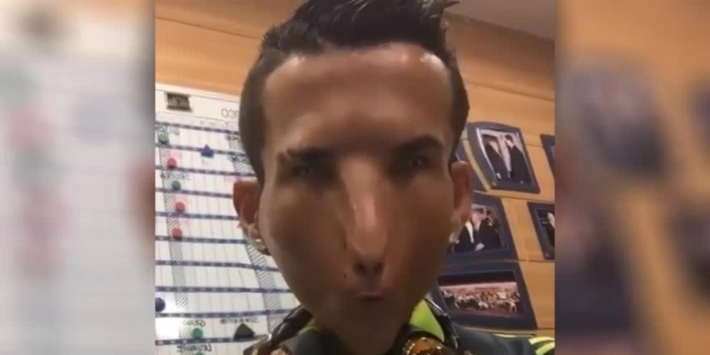 Ronaldo Permak Wajahnya Jadi Mirip Alien Ronaldo Permak Wajahnya Jadi Mirip Alien