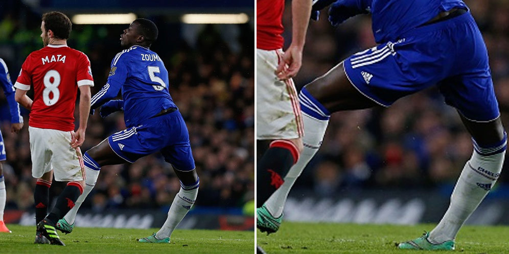 Horor, Detik-detik Cederanya Kurt Zouma Horor, Detik-detik Cederanya Kurt Zouma
