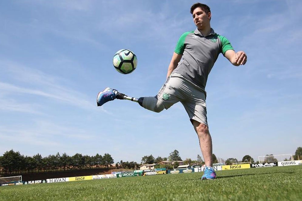 Kaki Diamputasi, Korban Selamat Chapecoense Masih Bisa Cetak Gol Kaki Diamputasi, Korban Selamat Chapecoense Masih Bisa Cetak Gol