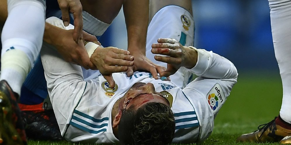 Cristiano Ronaldo tergeletak dengan berdarah-darah.