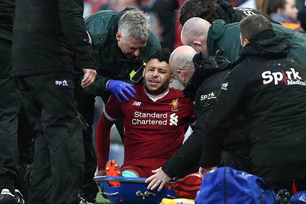Chamberlain Cedera, Klopp Harus Putar Otak