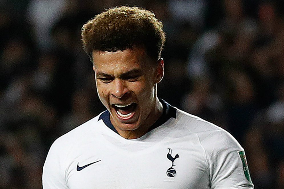 Resmi, Dele Alli Tidak Bisa Perkuat Tottenham Lawan Manchester United Resmi, Dele Alli Tidak Bisa Perkuat Tottenham Lawan Manchester United