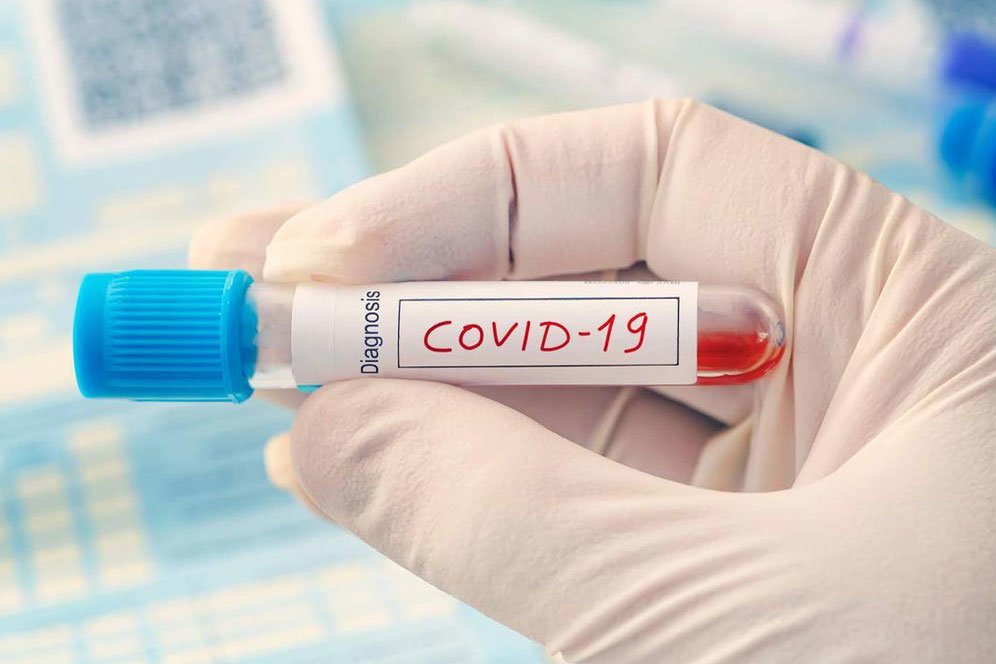Penting, Pahami Cara Kerja Rapid Test Virus Corona Penting, Pahami Cara Kerja Rapid Test Virus Corona
