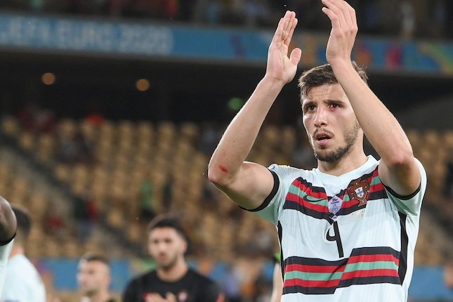 Ruben Dias Ruben Dias