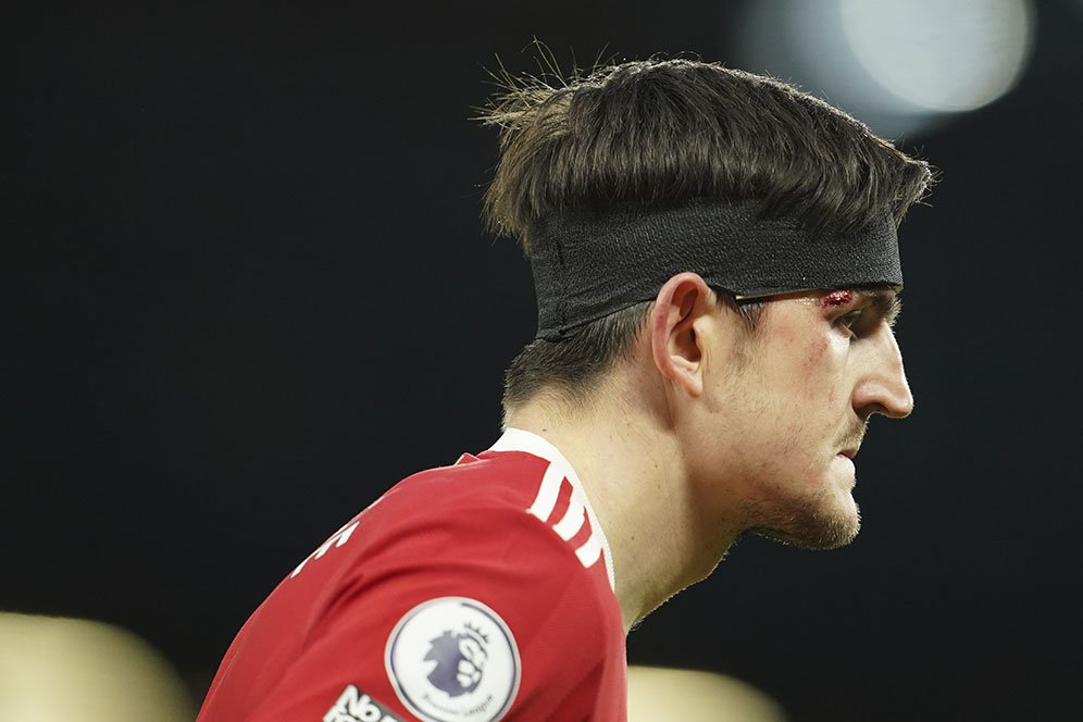 Harry Maguire Absen di Laga MU vs Wolves, Ada Apa? Harry Maguire Absen di Laga MU vs Wolves, Ada Apa?