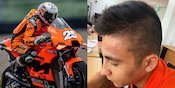 Raul Fernandez Tunjukkan Memar Kepala Usai Jatuh di Mandalika, Akui Rasa Takut Raul Fernandez Tunjukkan Memar Kepala Usai Jatuh di Mandalika, Akui Rasa Takut
