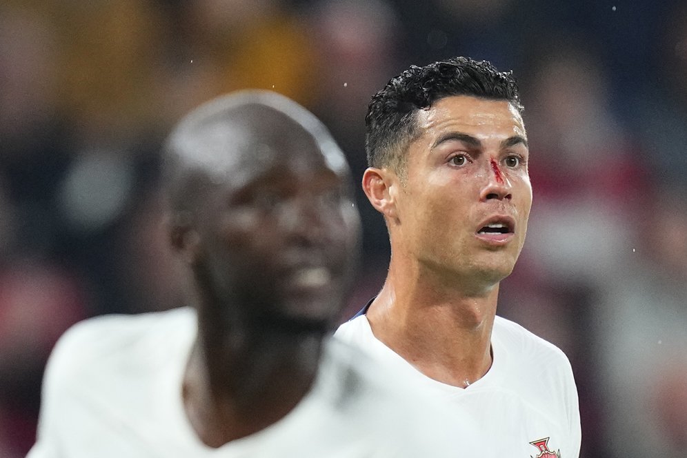 Dedikasi Tinggi! Cristiano Ronaldo Tetap Berlatih dengan Mata Hitam Usai Sempat Berdarah-Darah