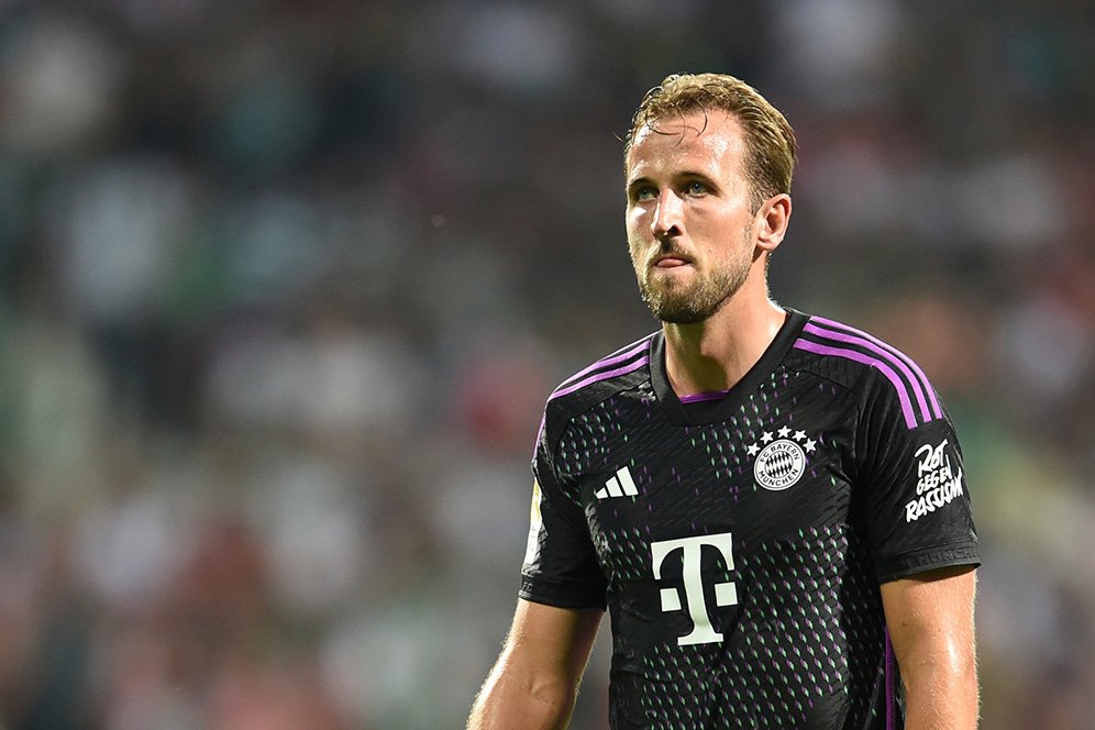 Meski MU Sedang Linglung, Bayern Munchen Janji Tak Anggap Sepele: Mereka Tim Kuat