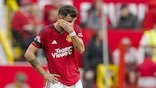 Kekecewaan Pemain Manchester United Setelah Dipecundangi Brighton and Hove Albion
