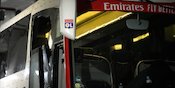 Ngeri! Wajah Manajer Lyon Terluka Parah Dilempari Batu oleh Pendukung Marseille, Laga Ditunda Ngeri! Wajah Manajer Lyon Terluka Parah Dilempari Batu oleh Pendukung Marseille, Laga Ditunda