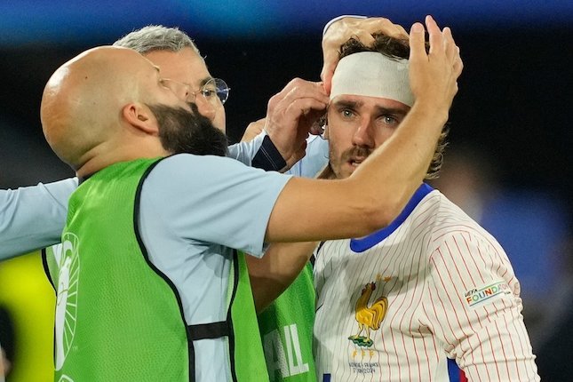 Kepala Antoine Griezmann Bocor Kepala Antoine Griezmann Bocor