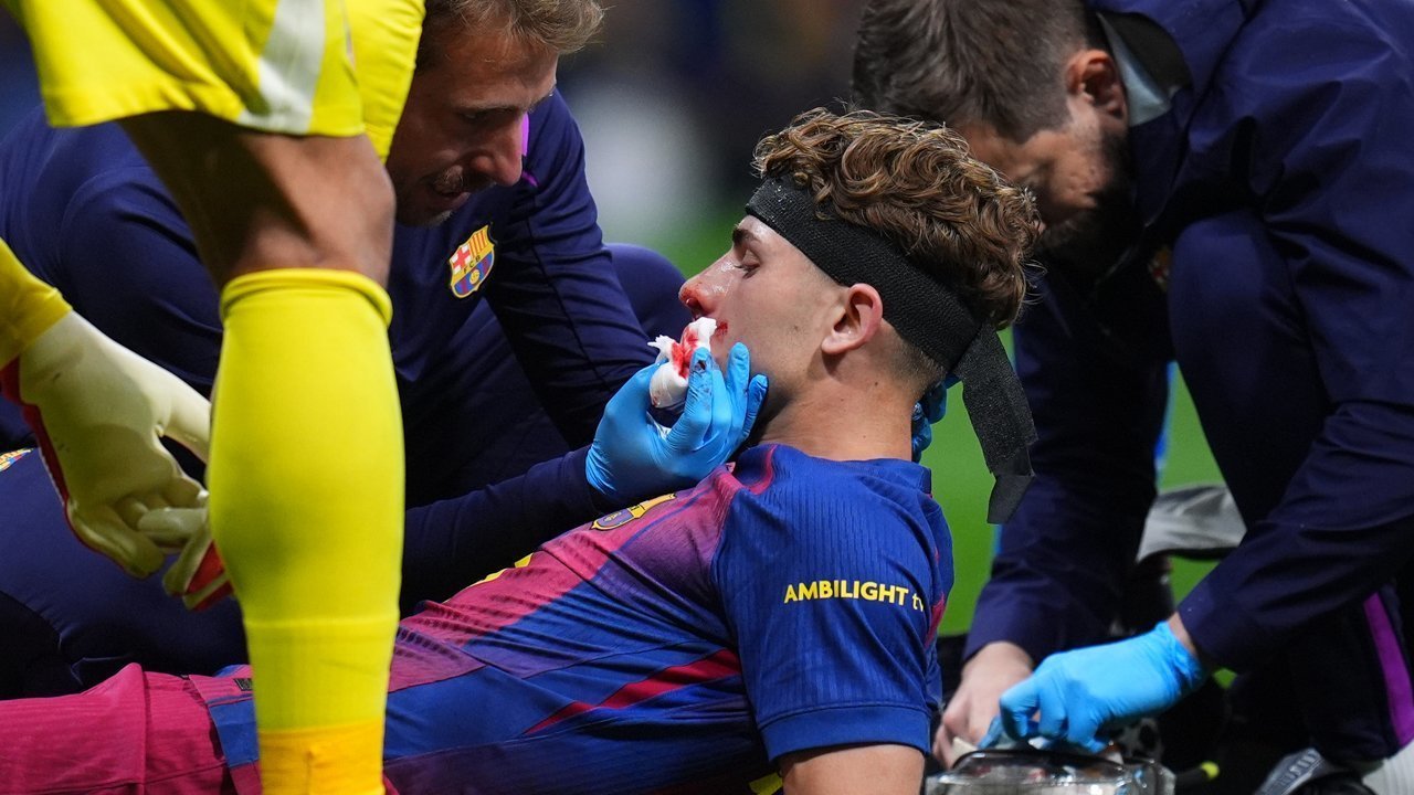 Ngilu! Cedera Horor Dialami Fermin Lopez di Laga Atletico Madrid vs Barcelona, Wajahnya Sampai Berdarah Ngilu! Cedera Horor Dialami Fermin Lopez di Laga Atletico Madrid vs Barcelona, Wajahnya Sampai Berdarah